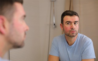 Mann mit Hautrötung im Gesicht