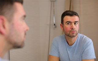 Mann mit Hautrötung im Gesicht